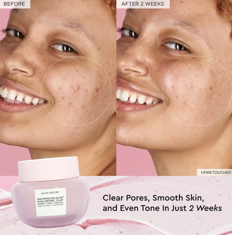 Glow Recipe Watermelon Glow Hyaluronic Clay Pore Tight Facial Face Mask