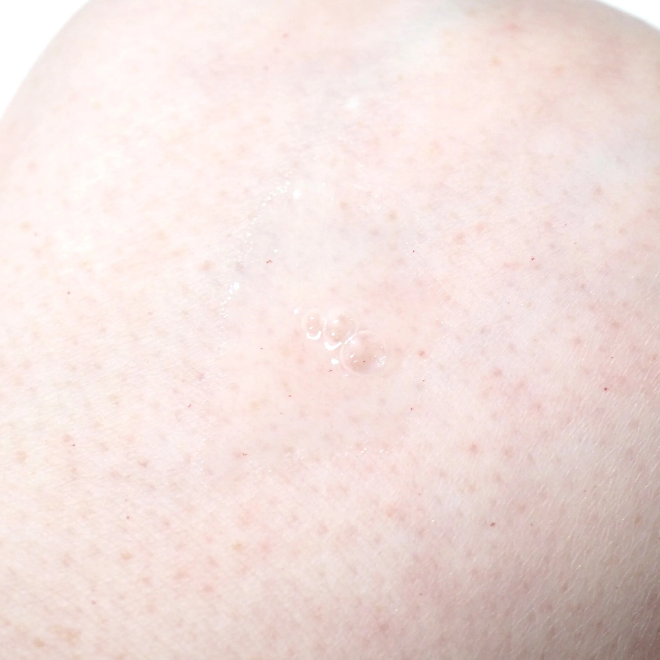 By Beauty Bay SkinHit Hydrating Serum Review