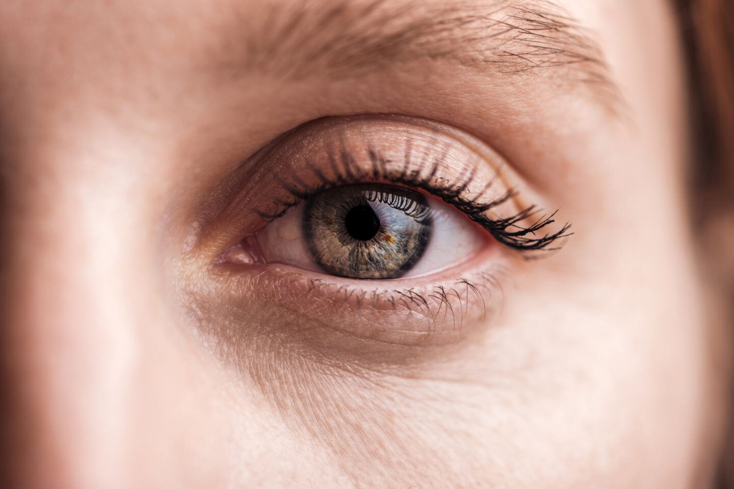Ingrown Eyelash Home Remedy: Fix That Ingrown Lash!