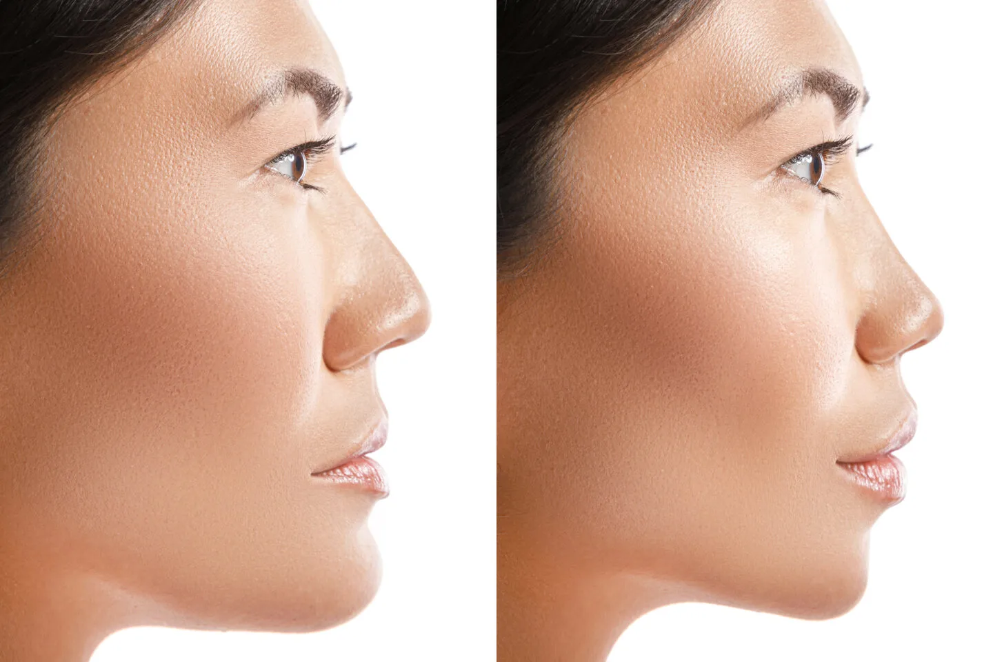 high cheekbones vs low cheekbones - what is the difference