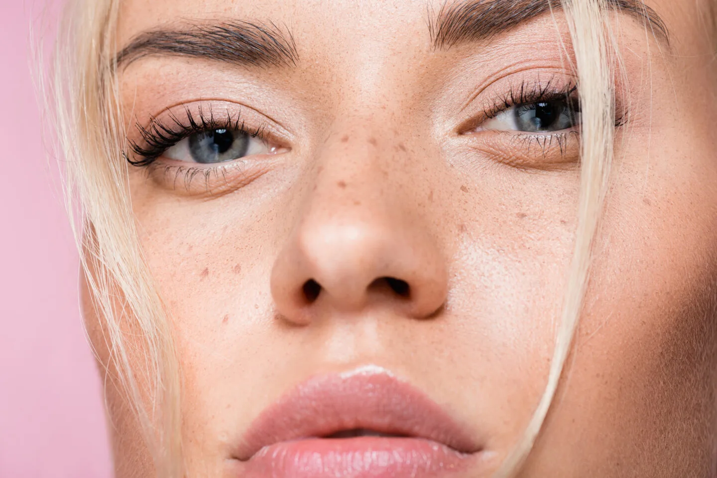 age spots, freckles and hyper pigmentation spots