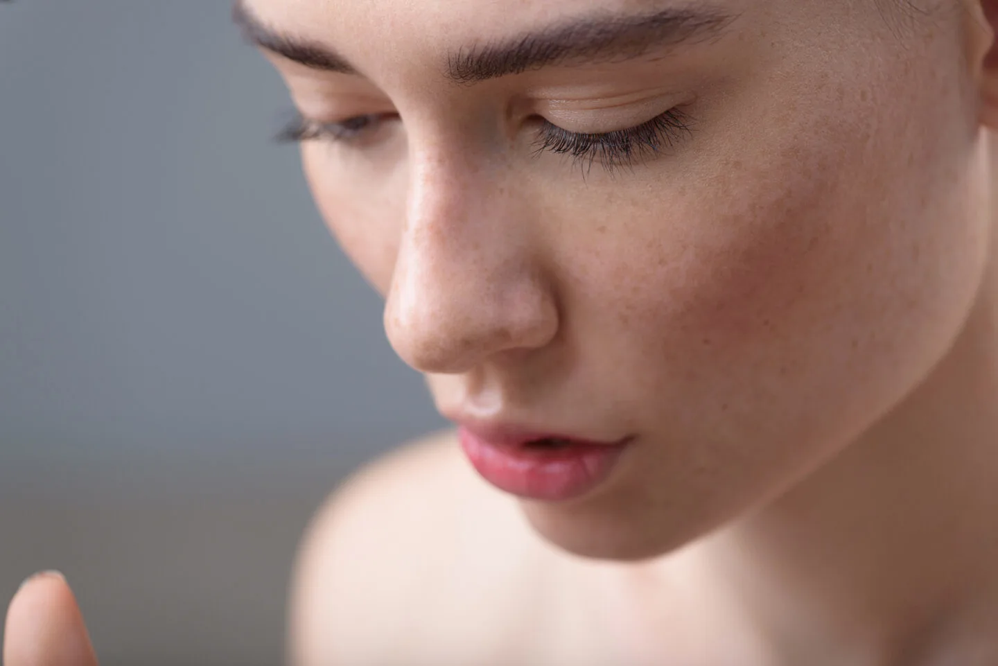 What professional treatments can help hyperpigmentation?