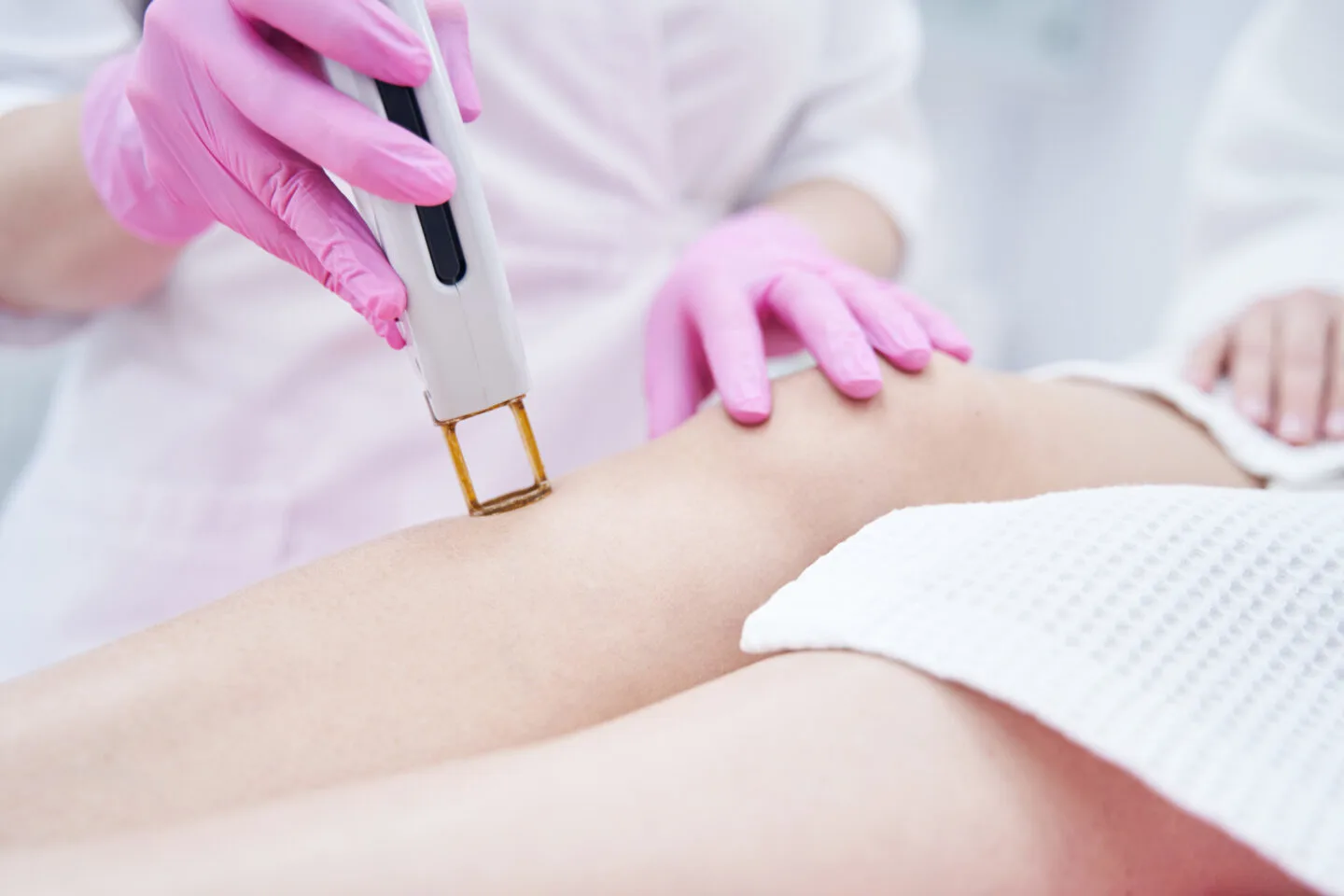 Can You Tan After Laser Hair Removal
