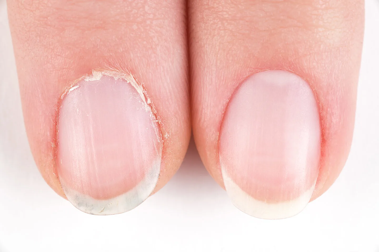 What Are The Best Oils For Nail Growth You Need To Try? 1 What Are The Best Oils For Nail Growth You Need To Try