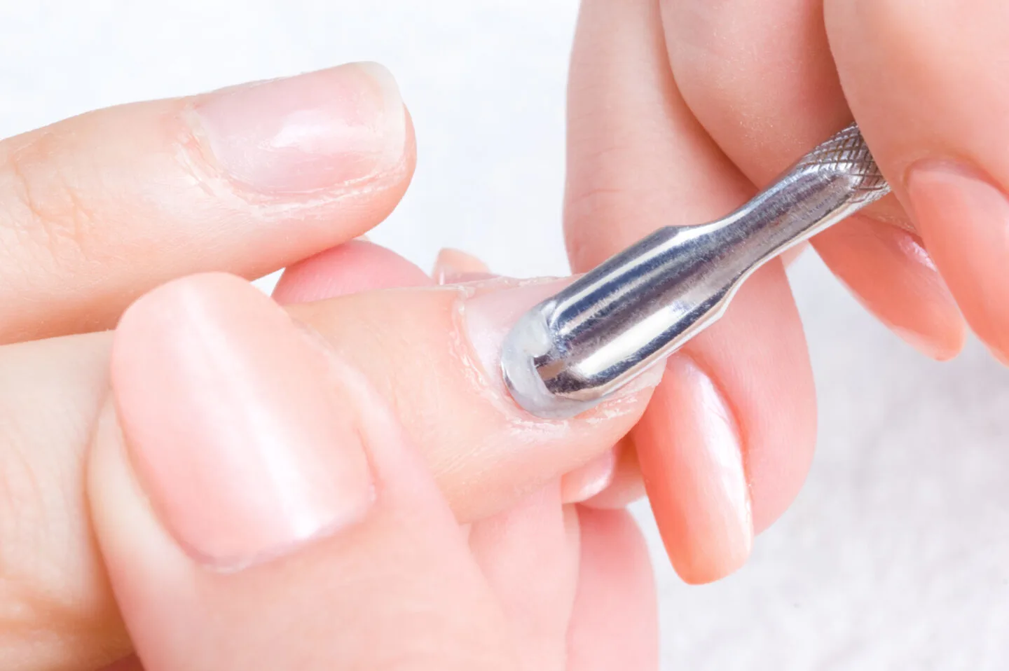 What causes cuticle infections?
