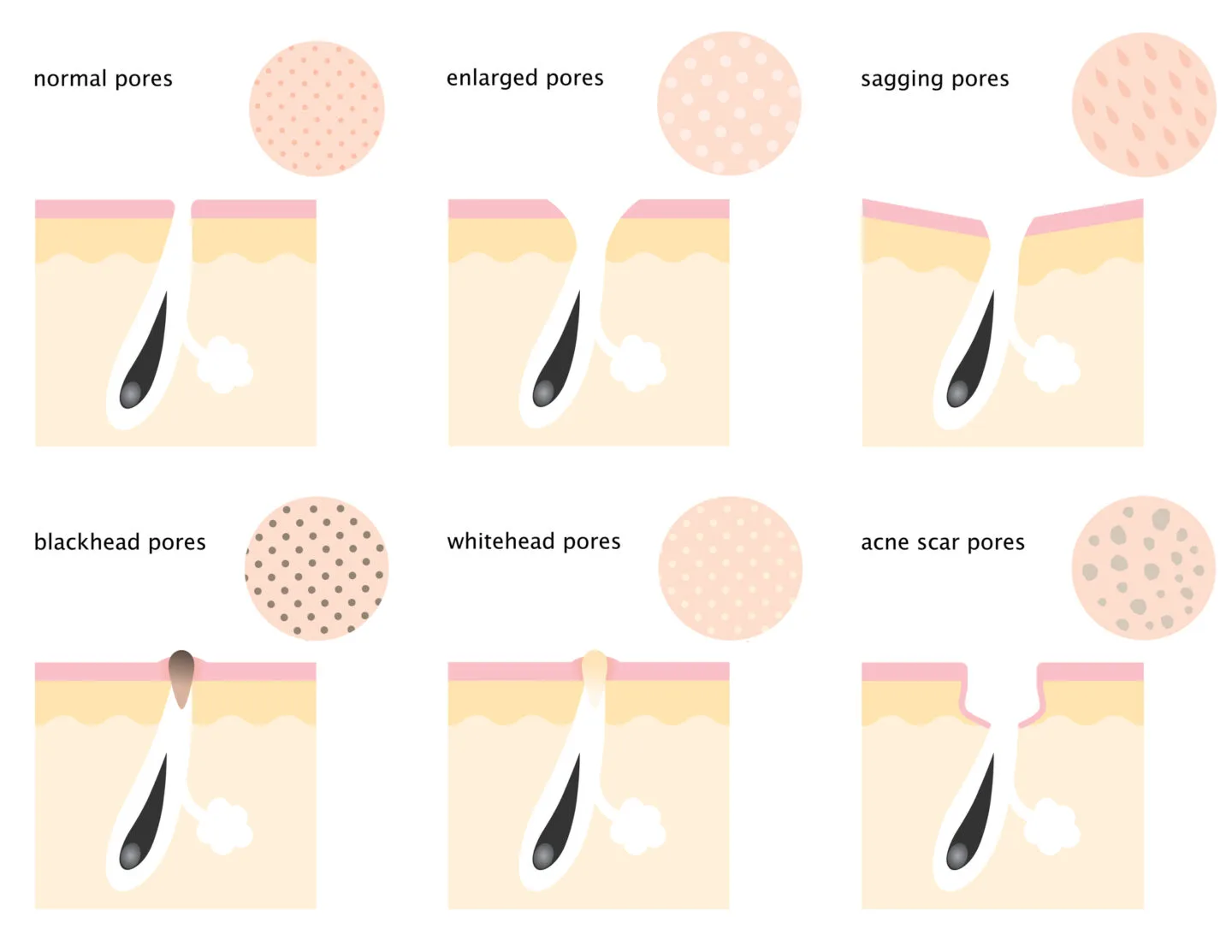 Are Pore Strips Bad For Your Skin Like People Claim?