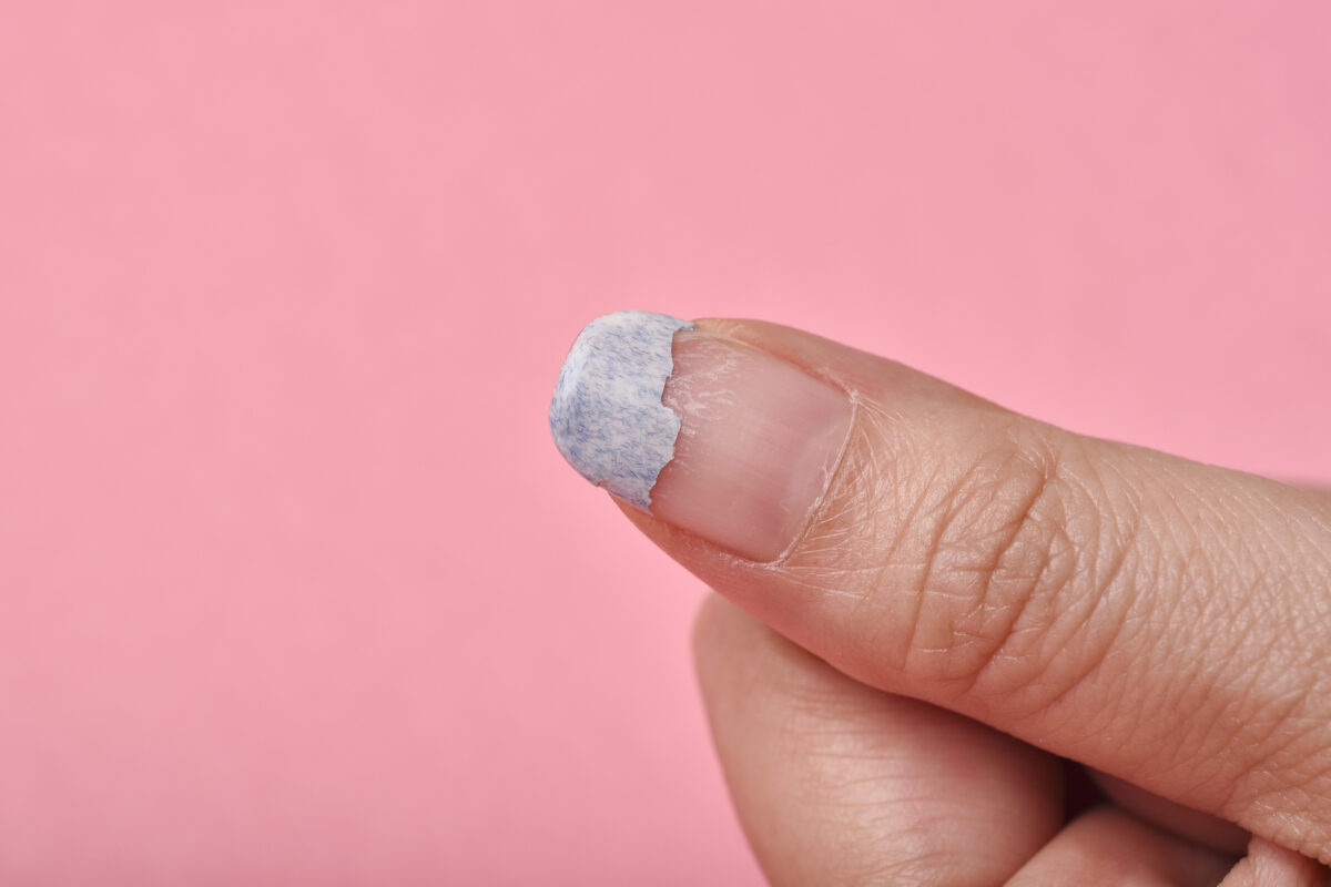 Why Does My Nail Polish Peel Off? [Surprising Answer]