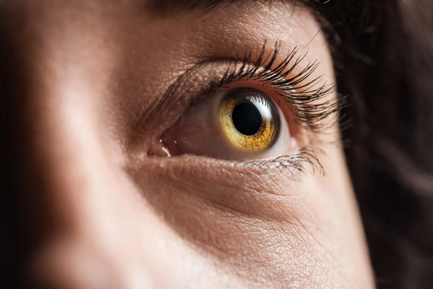What Can You Do When Eyelashes Grow In Corner Of Eye?
