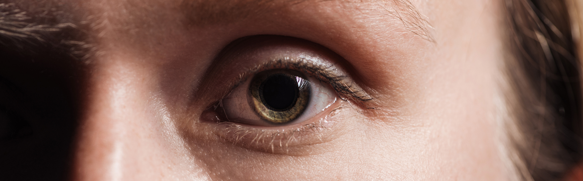 What Can You Do When Eyelashes Grow In Corner Of Eye?