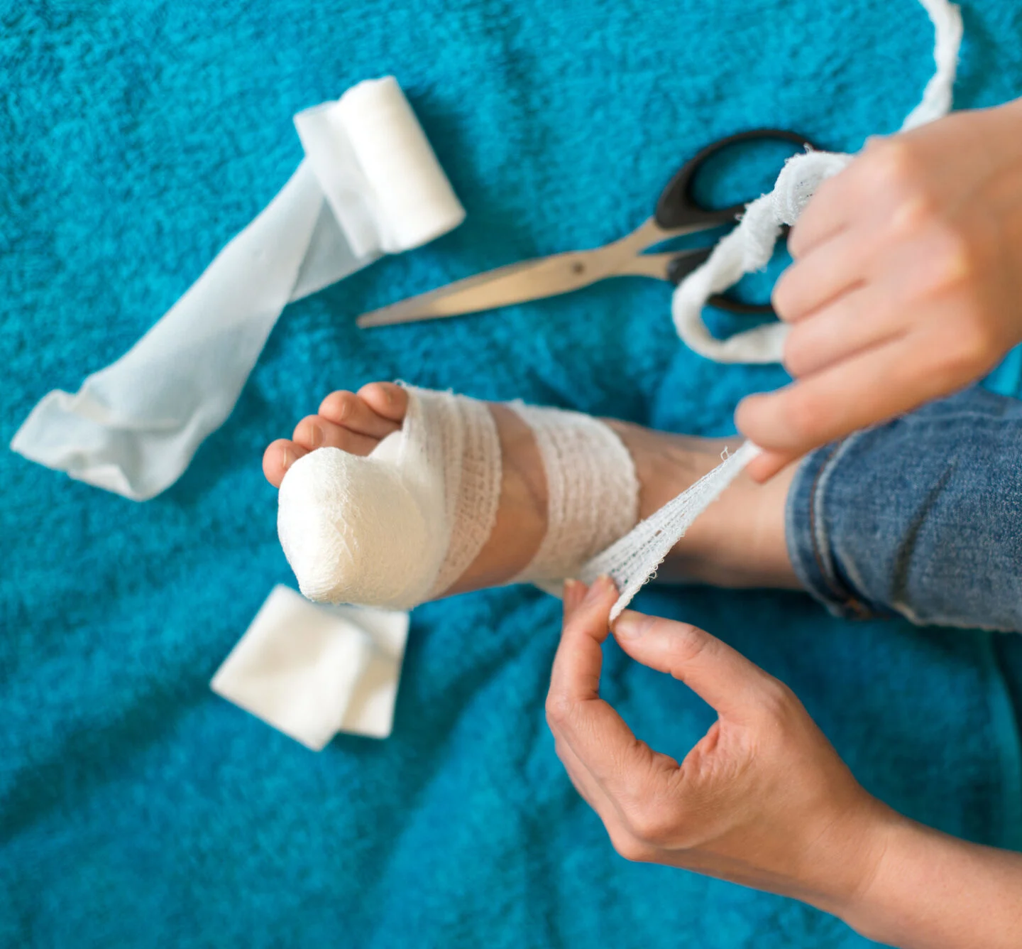 How Can Nail Clippers Lead To Ingrown Nails?