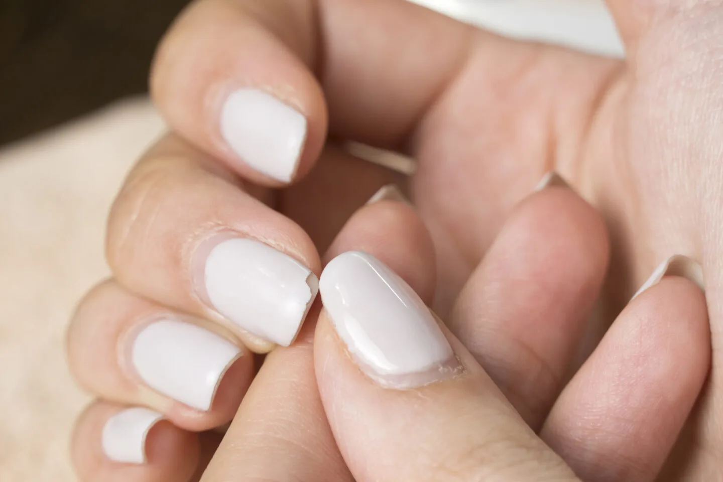 How to Stop Nails from Curling Under [Complete Guide]