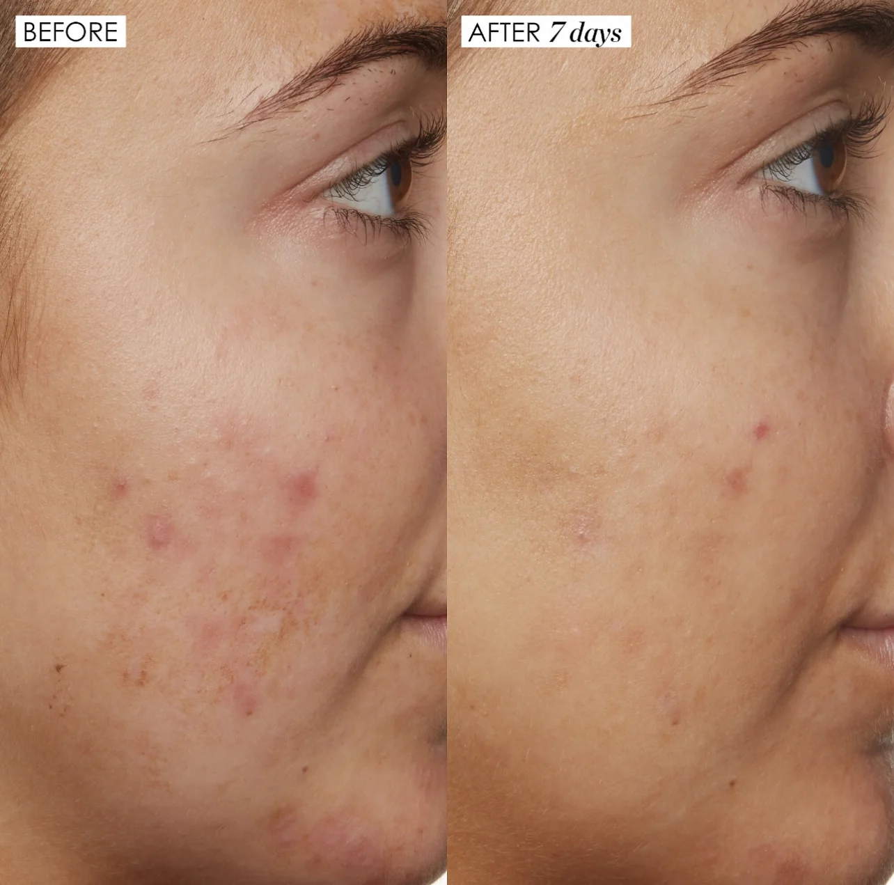 Sunday Riley B3 Nice 10% Niacinamide Serum