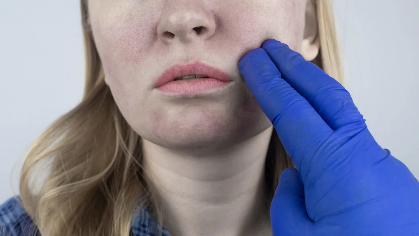 How To Tell If Your Lotion Is Clogging Your Pores?
