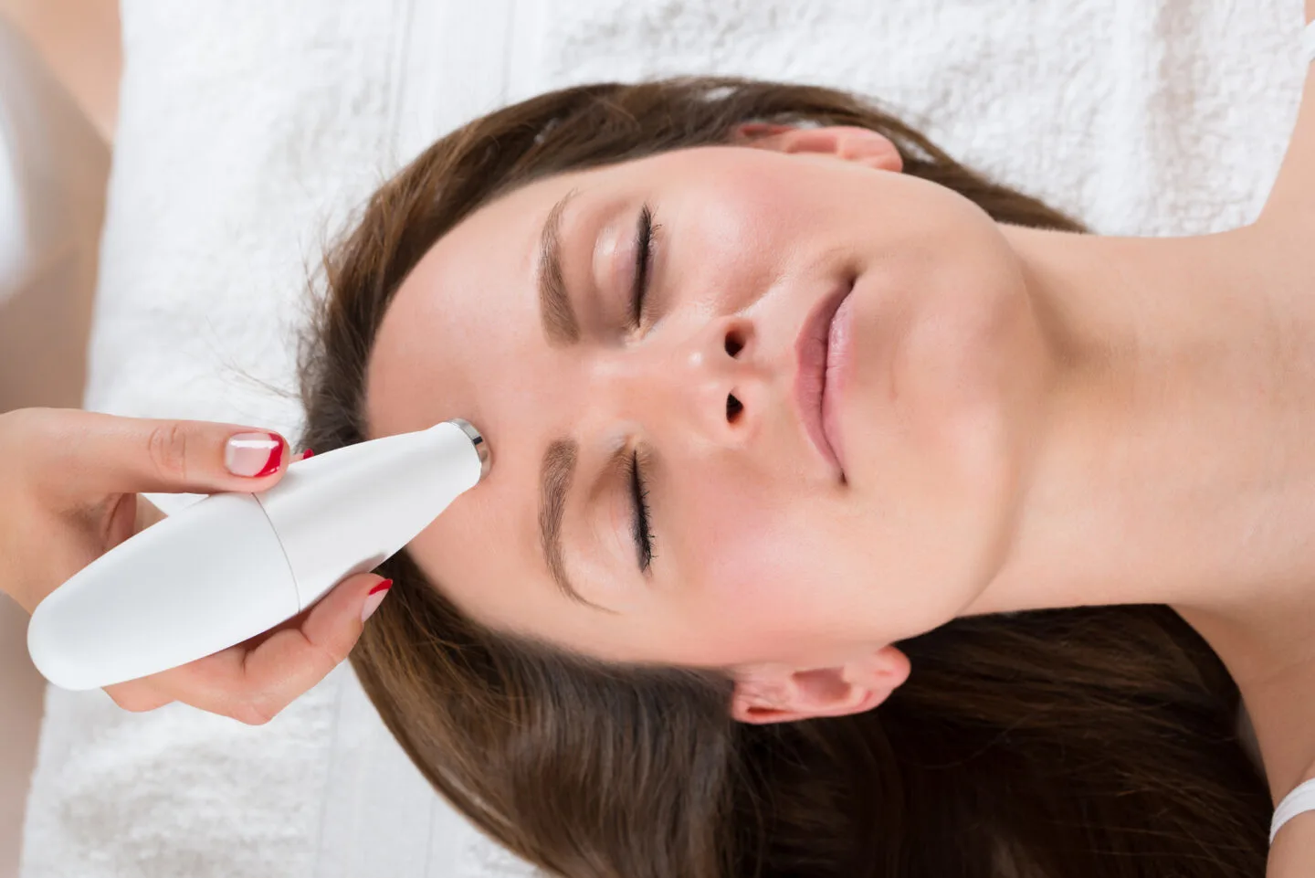 Microdermabrasion vs Chemical Peel - Which Is Best?