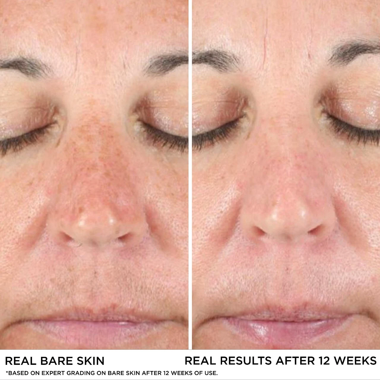 IT Cosmetics Bye Bye Dark Spots Concealer + Serum