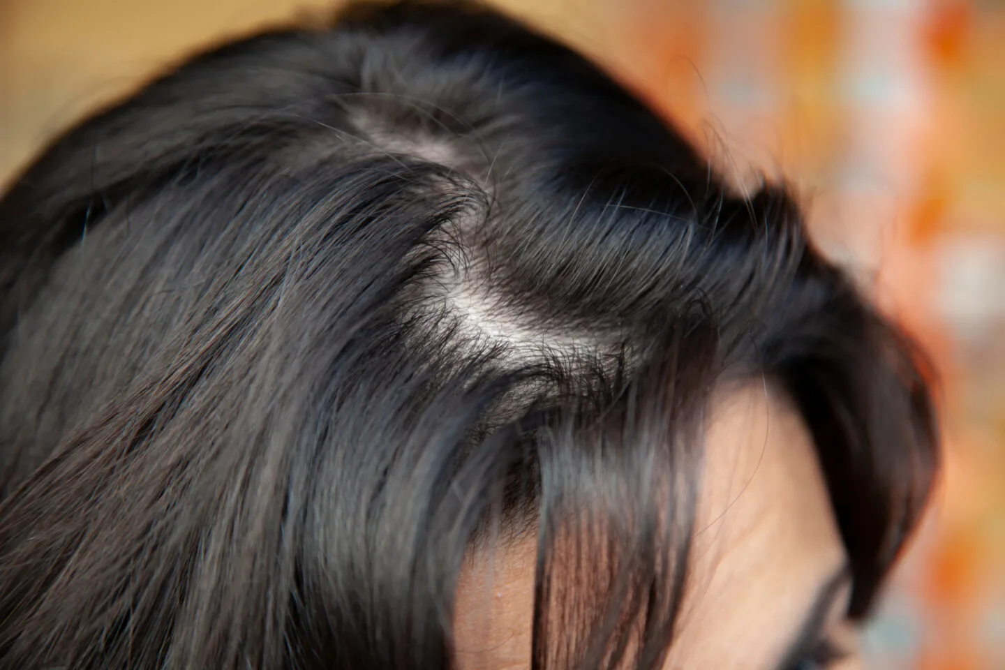 Do You Need To Exfoliate Your Scalp?